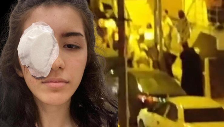 Evinin önünde oturan 16 yaşındaki çocuğa maganda kurşunu… Sol gözünü kaybetti
