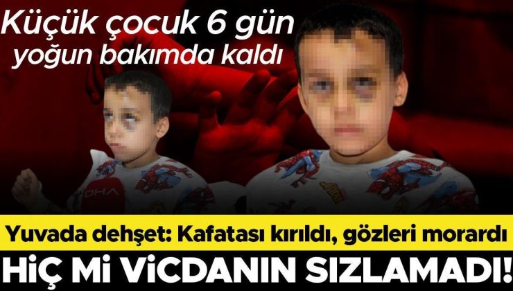 Yuvada bakıcı dehşeti! Dövüp yere fırlattığı çocuğun kafatası kırıldı, gözleri morardı