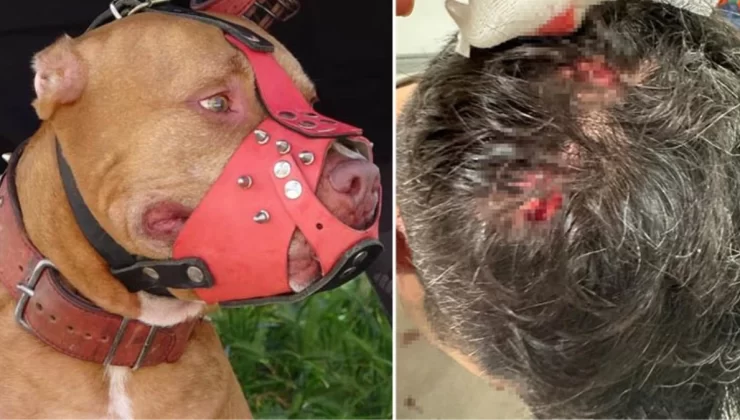 Bekçi ile boksör arasında ‘ağızlıksız pitbull’ kavgası: Sopayı aldım ikisinin kafasına geçirdim