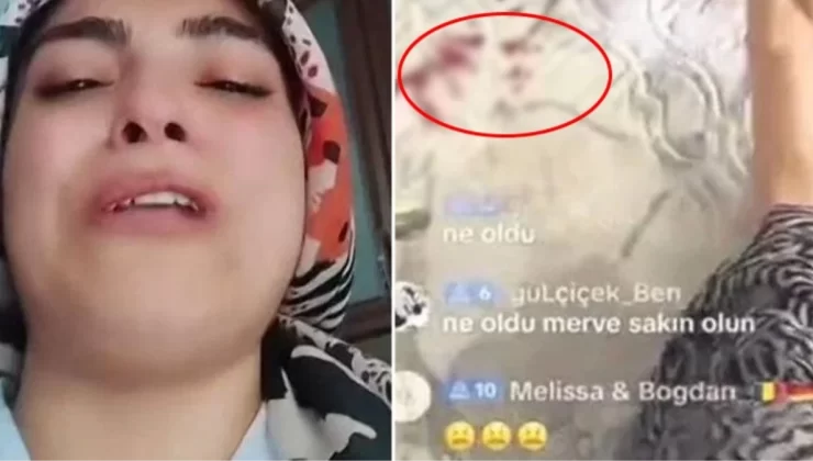 TikTok’taki rezaletler bitmiyor! Çocuğu kanlar içindeyken canlı yayın açtı