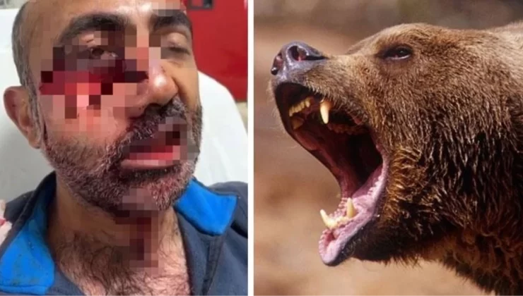 Tarlasına giden adam ölümden döndü! Ayı saldırısında suratı parçalandı, çene kemiği kırıldı