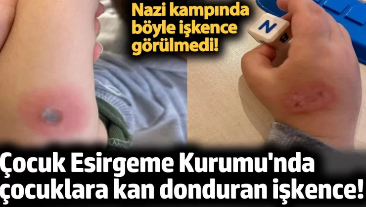 Çocuk Esirgeme Kurumu’nda çocuklara kan donduran işkence! Nazi kampında böyle işkence görülmedi