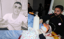 Boşandığı erkek tarafından 13 yerinden bıçaklanmıştı: Kafatası kemiği karnına yerleştirildi