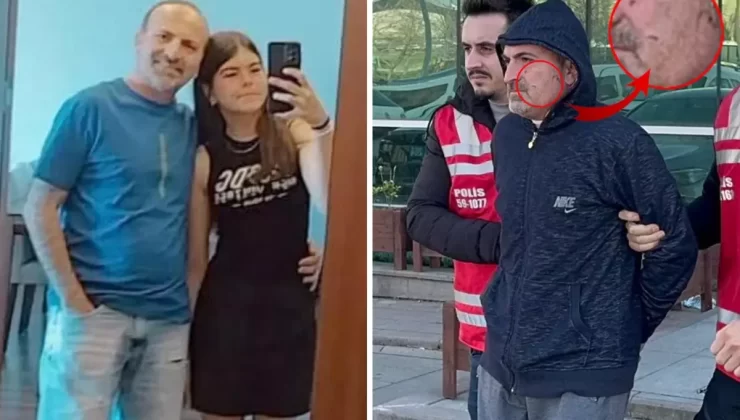 Cani babanın yüzünde boğarak öldürdüğü kızının tırnak izleri görüntülendi