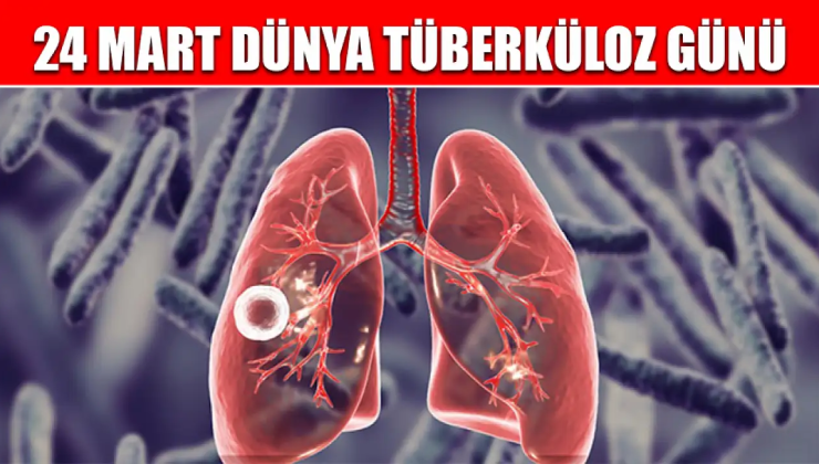 Sağlık Bakanlığının 24 Mart ‘‘Dünya Tüberküloz Günü” Açıklaması