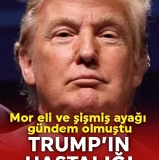 Trump’ın hastalığı dikkat çekti
