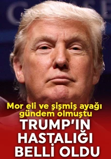 Trump’ın hastalığı dikkat çekti