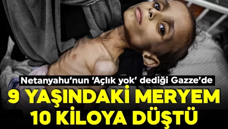 Gazze’de açlık yavaş yavaş öldürüyor! 9 yaşındaki Meryem 10 kiloya düştü! ‘Bu benim kızım mı?’
