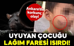 Ankara’da korkunç olay! Evde uyuyan çocuğu lağım faresi ısırdı