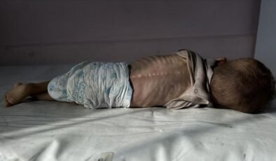 UNICEF: Gazze’de her 5 çocuktan 1’i akut yetersiz beslenme yaşıyor