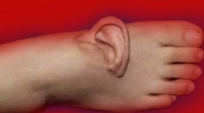 Kopan kulağını ayağına diktiler