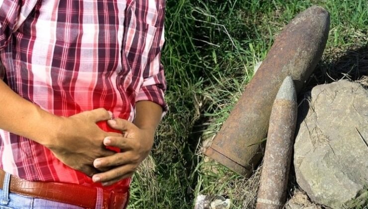 Hastanın makatında 1. Dünya Savaşı'ndan kalma top mermisi çıktı