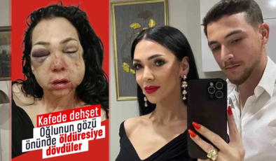 İzmit’te dehşet anları! Yardım etmek istedi, öldüresiye dövdüler: ‘Küfür etmeyin’ dedik diye bu hale geldim