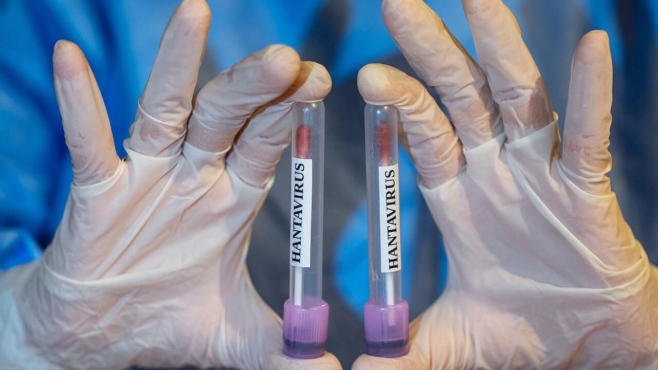 DSÖ: Hantavirüs vakalarıyla ilgili durum istikrarlı