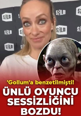 Son hali ‘Gollum’a benzetilmişti! Olivia Wilde’dan yorumlara tepki