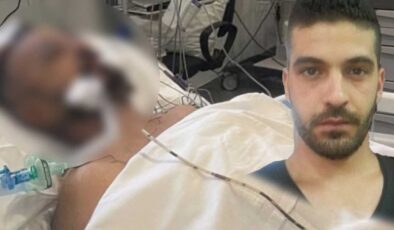 Burak Anıldı: Aya Napa saldırısı, 2015'te yaşadığımız ırkçı saldırıyı hatırlattı