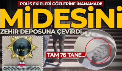 Polisi bile şaşkına çevirdi! Midesini zehir deposuna çevirdi: 76 parça çıktı