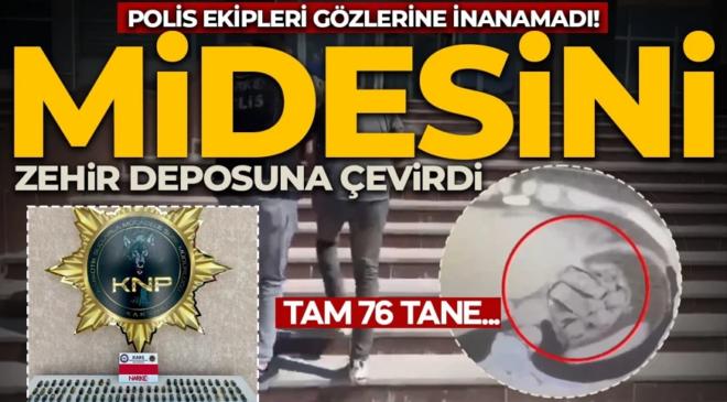 Polisi bile şaşkına çevirdi! Midesini zehir deposuna çevirdi: 76 parça çıktı