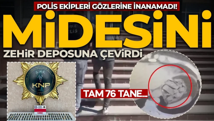 Polisi bile şaşkına çevirdi! Midesini zehir deposuna çevirdi: 76 parça çıktı