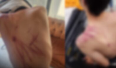 Valilik 'hafif yaralandı' dedi: Rehabilitasyon merkezinde korkunç işkence