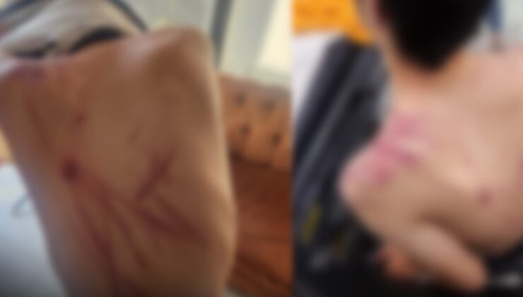 Valilik 'hafif yaralandı' dedi: Rehabilitasyon merkezinde korkunç işkence