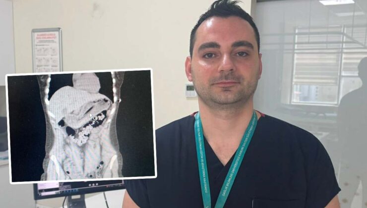 Zayıflamak isterken 13 santimetrelik diş fırçası yuttu: Doktorlar bile şaştı kaldı